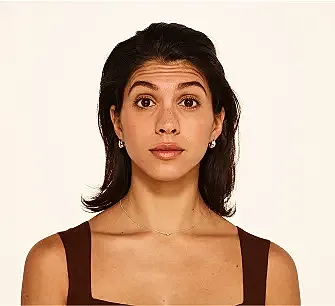 Botox Before & After