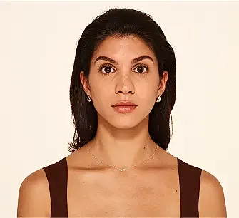 Botox Before & After