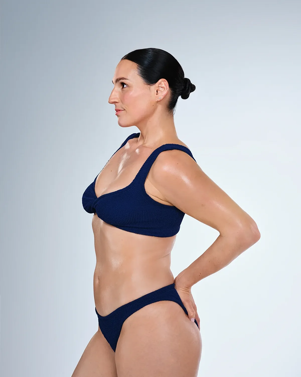 Coolsculpting Before & After