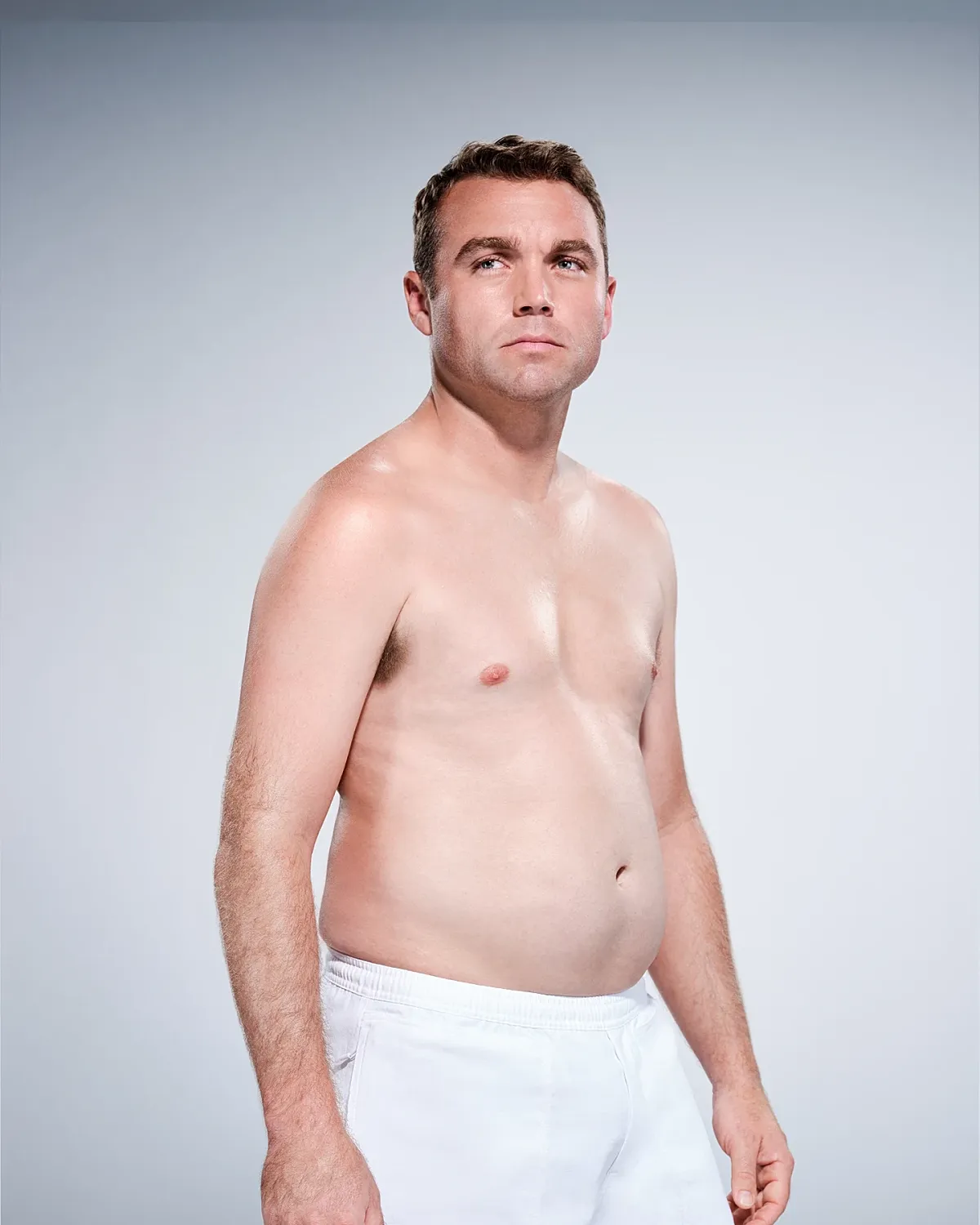 Coolsculpting Before & After
