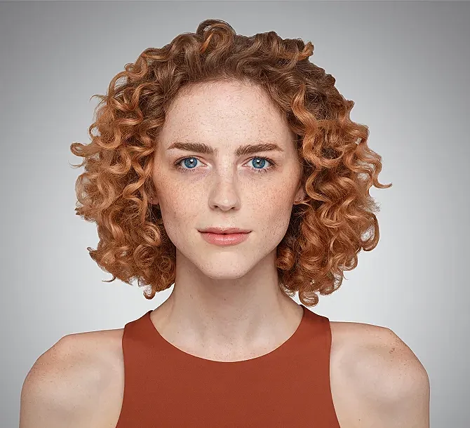 Juvederm Before & After
