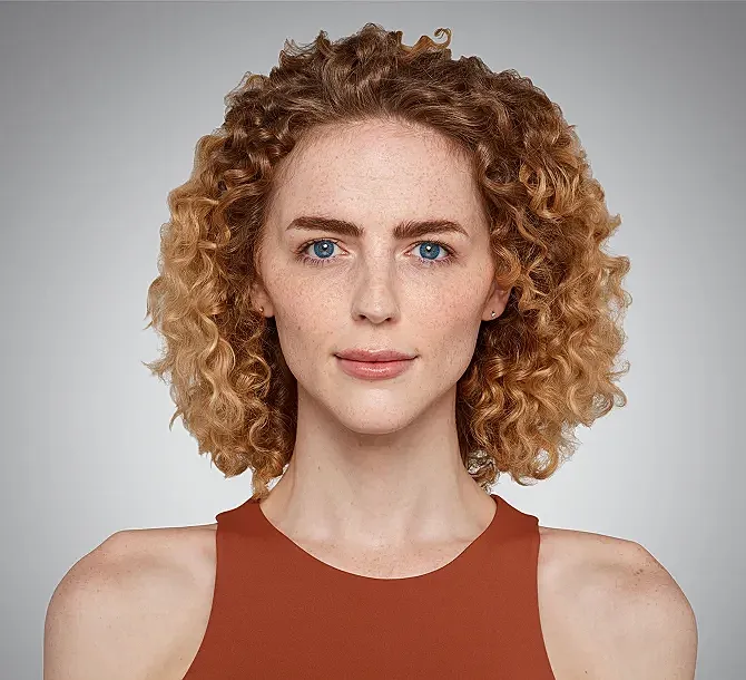 Juvederm Before & After